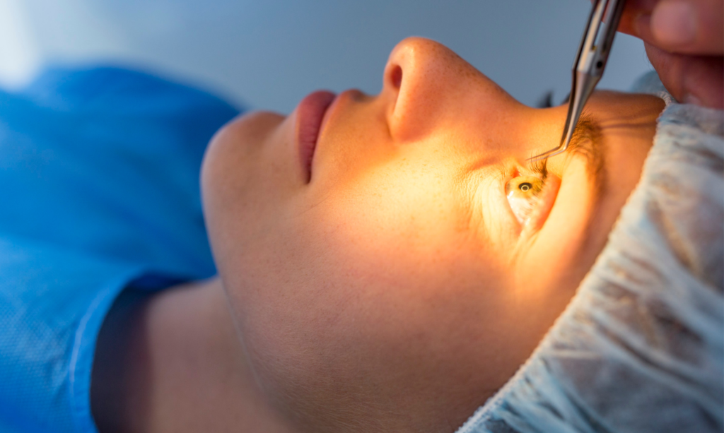 Refractive Surgery in Dhule